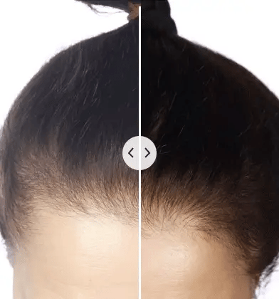 ChicBlend – 5-in-1 Scalp Care Hair Tool