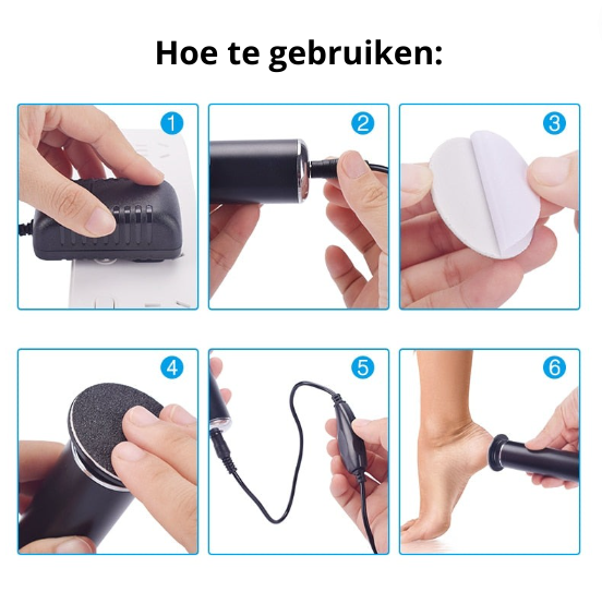 SmoothFeet Electric Callus Remover