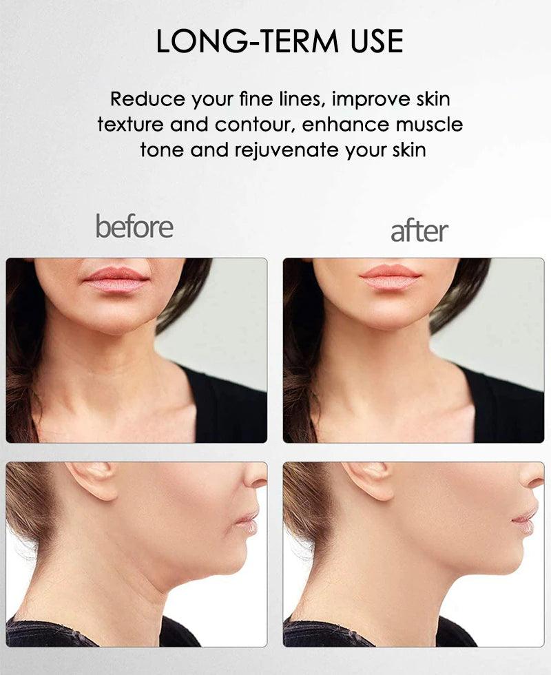 FirmGlow Microcurrent Facial Massager